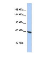 Western blot of Human HepG2. SYNE3 antibody dilution 1.0 ug/ml.