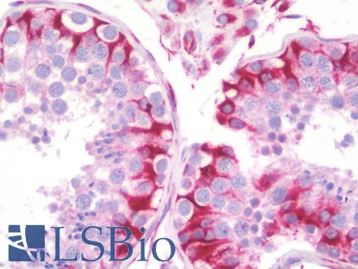 Anti-SYNE3 / C14orf49 antibody IHC staining of human testis. Immunohistochemistry of formalin-fixed, paraffin-embedded tissue after heat-induced antigen retrieval. Antibody LS-B9849 concentration 10 ug/ml.