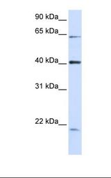 293T cell lysate. Antibody concentration: 1.0 ug/ml. Gel concentration: 12%.