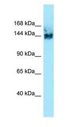 SYNGAP antibody Western Blot of Fetal kidney.