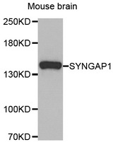 Western blot analysis of extracts of Mouse brain cell line, using SYNGAP1 antibody.