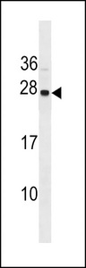 SYNGR1 Antibody western blot of MDA-MB453 cell line lysates (35 ug/lane). The SYNGR1 antibody detected the SYNGR1 protein (arrow).