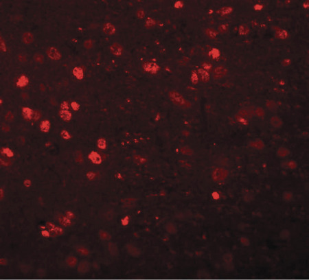 Immunofluorescence of SYNGR1 in rat brain tissue with SYNGR1 antibody at 20 ug/ml.
