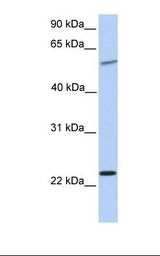 721_B cell lysate. Antibody concentration: 1.0 ug/ml. Gel concentration: 12%.