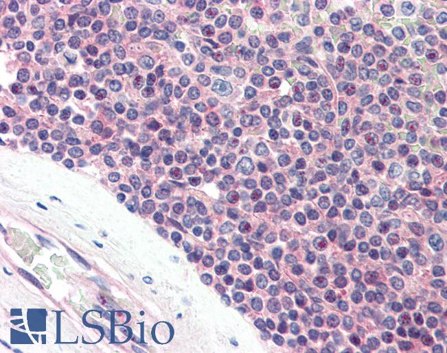 Anti-SYNGR2 / Synaptogyrin 2 antibody LS-A9844 IHC of human spleen. Immunohistochemistry of formalin-fixed, paraffin-embedded tissue after heat-induced antigen retrieval.
