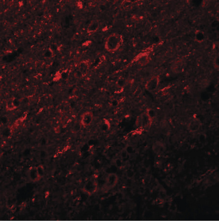 Immunofluorescence of SYNGR2 in rat brain tissue with SYNGR2 antibody at 20 ug/ml.