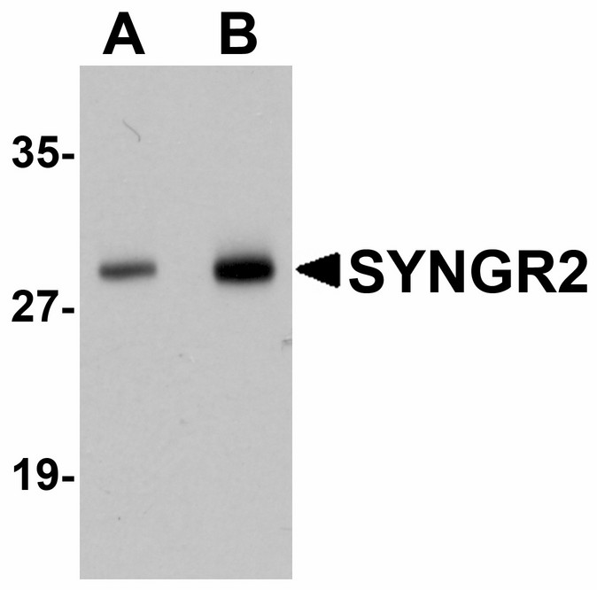 Western blot of SYNGR2 in human lung tissue lysate with SYNGR2 antibody at (A) 1 and (B) 2 ug/ml.