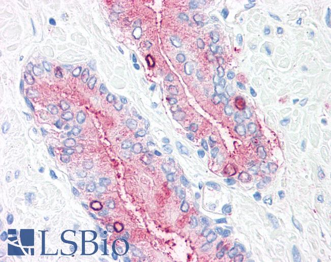 Anti-SYNGR2 / Synaptogyrin 2 antibody LS-A9135 IHC of human, prostate. Immunohistochemistry of formalin-fixed, paraffin-embedded tissue after heat-induced antigen retrieval.