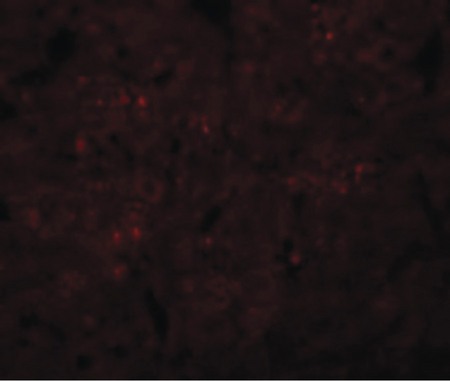 Immunofluorescence of SYNGR3 in Rat Brain cells with SYNGR3 antibody at 20 ug/ml.