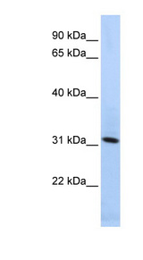 SYNGR4 / Synaptogyrin 4 antibody LS-C102257 Western blot of HepG2 cell lysate.