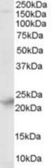 Antibody (0.01 ug/ml) staining of Human Brain lysate (35 ug protein in RIPA buffer). Primary incubation was 1 hour. Detected by chemiluminescence.
