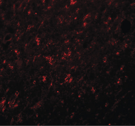 Immunofluorescence of SYNGR4 in rat brain tissue with SYNGR4 antibody at 20 ug/ml.