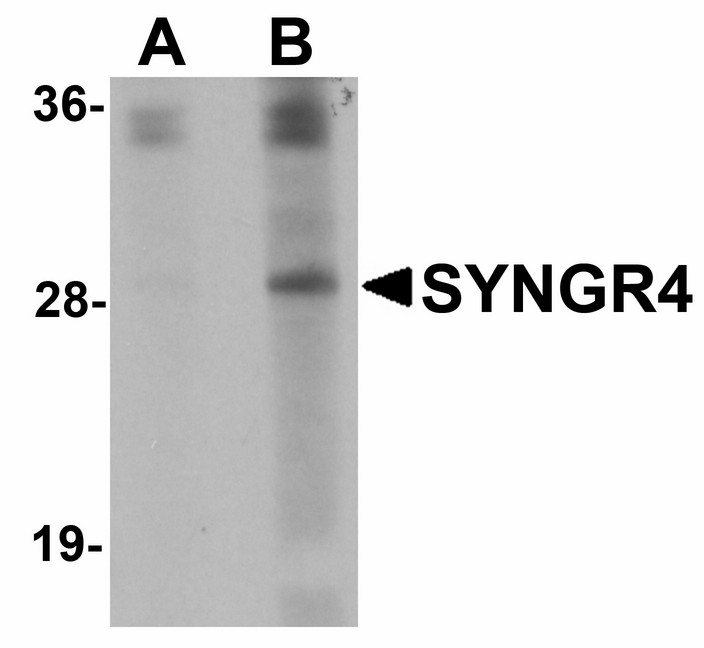 Western blot of SYNGR4 in K562 cell lysate with SYNGR4 antibody at (A) 1 and (B) 2 ug/ml.