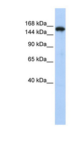 SYNJ1 / Synaptojanin antibody LS-C101850 Western blot of HepG2 cell lysate.
