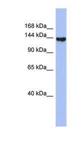 SYNJ2 / Synaptojanin 2 antibody LS-C110527 Western blot of THP-1 cell lysate.