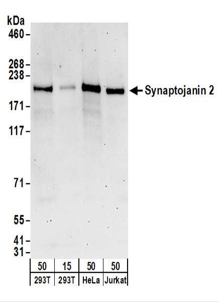 Detection of Human Synaptojanin 2 by Western Blot. Samples: Whole cell lysate from 293T (15 and 50 ug), HeLa (50 ug), and Jurkat (50 ug) cells. Antibodies: Affinity purified rabbit anti-Synaptojanin 2 antibody used for WB at 0.1 ug/ml. Detection: Chemiluminescence with an exposure time of 3 minutes.