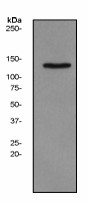 Western blot analysis on SH-SY5Y cell lysates using anti-Synaptojanin 2 antibody (LS-C105269), 1:500 dilution.