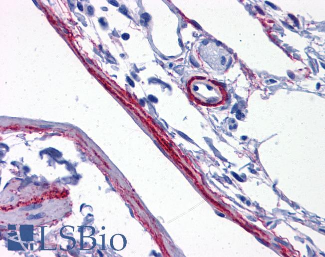 Anti-SYNPO / Synaptopodin antibody IHC of human perivascular processes. Immunohistochemistry of formalin-fixed, paraffin-embedded tissue after heat-induced antigen retrieval. Antibody LS-B5353 concentration 5 ug/ml.