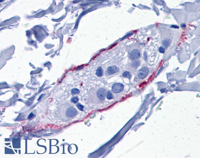 Anti-SYNPO / Synaptopodin antibody IHC of human perineural processes. Immunohistochemistry of formalin-fixed, paraffin-embedded tissue after heat-induced antigen retrieval. Antibody LS-B5353 concentration 5 ug/ml.