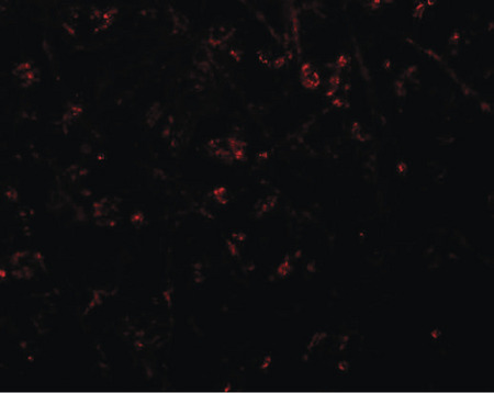 Immunofluorescence of SYNPO in human brain tissue with SYNPO antibody at 20 ug/ml.