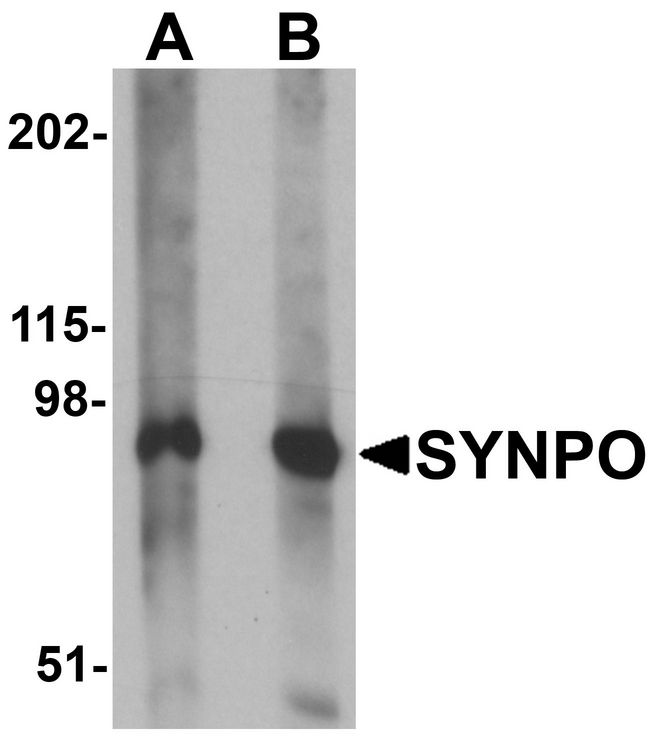 Western blot analysis of SYNPO in rat brain tissue lysate with SYNPO antibody at (A) 1 and (B) 2 ug/ml.