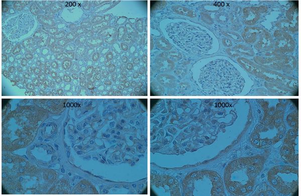 Staining for Synaptopodin on formalin fixed paraffin embedded kidney tissue sections using anti-SYNPO monoclonal antibody following antigen retrieval. Indirect immunoperoxidase staining. DAB substrate, hematoxylin counterstain.