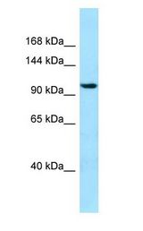 SYNPO2 / Synaptopodin 2 antibody Western Blot of 721_B.