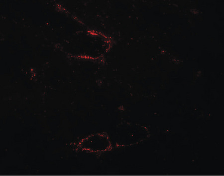 Immunofluorescence of SYNPO2L in mouse skeletal muscle tissue with SYNPO2L antibody at 20 ug/ml.
