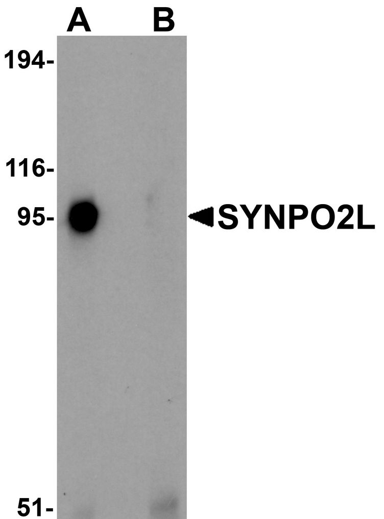 Western blot analysis of SYNPO2L in human thymus tissue lysate with SYNPO2L antibody at 1 ug/ml in (A) the absence and (B) the presence of blocking peptide.