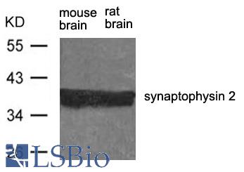 Western blot of extract from rat brain and mouse brain using synaptophysin 2 antibody.