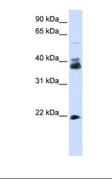 Transfected 293T cell lysate. Antibody concentration: 1.0 ug/ml. Gel concentration: 12%.