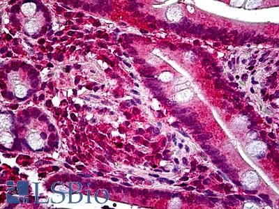 Anti-PTPRF antibody IHC of human small intestine. Immunohistochemistry of formalin-fixed, paraffin-embedded tissue after heat-induced antigen retrieval. Antibody LS-B5112 concentration 3.75 ug/ml.