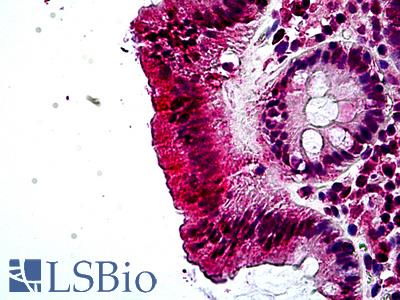 Anti-PTPRF antibody IHC of human colon. Immunohistochemistry of formalin-fixed, paraffin-embedded tissue after heat-induced antigen retrieval. Antibody LS-B5112 concentration 3.75 ug/ml.