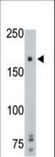 The anti-PTPgamma Center antibody is used in Western blot to detect PTPgamma in mouse brain tissue lysate.