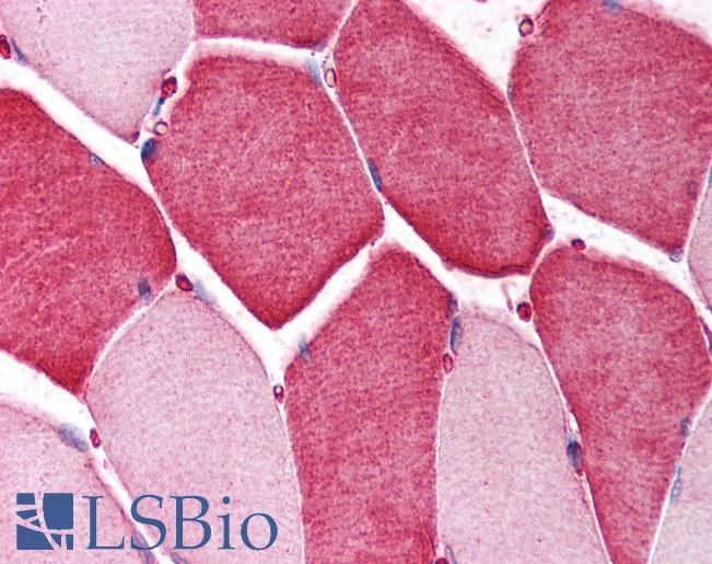 Anti-PTPRG antibody IHC of human skeletal muscle. Immunohistochemistry of formalin-fixed, paraffin-embedded tissue after heat-induced antigen retrieval. Antibody LS-B894 concentration 10 ug/ml.