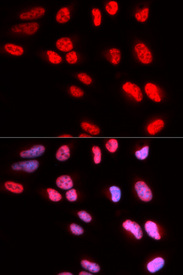 Immunofluorescence analysis of U20S cell using PRPF3 antibody. Blue: DAPI for nuclear staining.