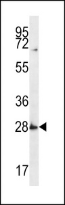 SYPL1 Antibody western blot of MDA-MB231 cell line lysates (35 ug/lane). The SYPL1 antibody detected the SYPL1 protein (arrow).