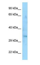 SYPL1 antibody Western Blot of Fetal Thymus.
