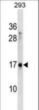 SYS1 Antibody western blot of 293 cell line lysates (35 ug/lane). The SYS1 antibody detected the SYS1 protein (arrow).
