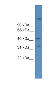 SYT11 antibody LS-C135529 Western blot of MCF7 cell lysate.