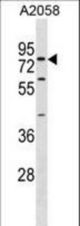 SYT16 Antibody western blot of A2058 cell line lysates (35 ug/lane). The SYT16 antibody detected the SYT16 protein (arrow).