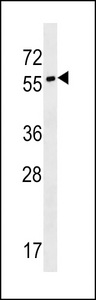 SYT17 Antibody western blot of NCI-H460 cell line lysates (35 ug/lane). The SYT17 antibody detected the SYT17 protein (arrow).