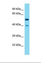 Western blot of Mouse Kidney. Syt17 antibody dilution 1.0 ug/ml.