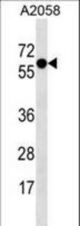 SYT4 Antibody western blot of A2058 cell line lysates (35 ug/lane). The SYT4 antibody detected the SYT4 protein (arrow).