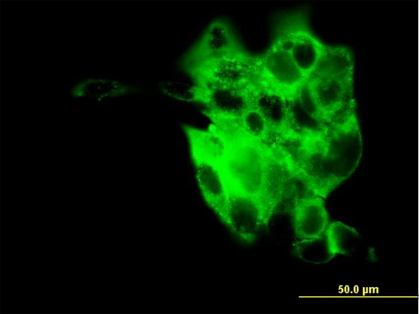 Immunofluorescence of monoclonal antibody to SYT4 on A-431 cell. [antibody concentration 10 ug/ml]