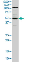 SYT4 monoclonal antibody (M04), clone 5F8 Western Blot analysis of SYT4 expression in A-431.
