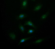 Immunofluorescent staining of HeLa cells using anti-SYT4 mouse monoclonal antibody.