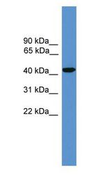 SYT5 antibody Western Blot of Fetal kidney lysate.