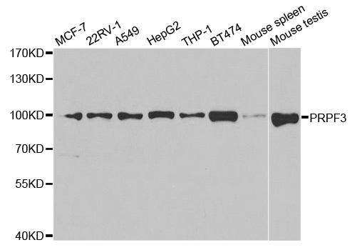 Western blot analysis of extracts of various cell lines, using PRPF3 antibody.