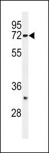 Western blot of HRD1 Antibody in SK-BR-3 cell line lysates (35 ug/lane). HRD1 (arrow) was detected using the purified antibody.